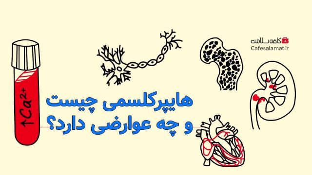هایپرکلسمی چیست و چه عوارضی دارد؟