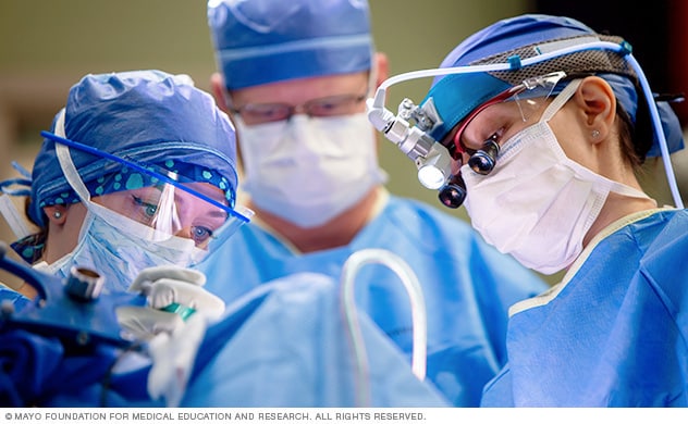 جراحان مغز و اعصاب در حال انجام جراحی صرع