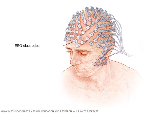 الکترودهای EEG