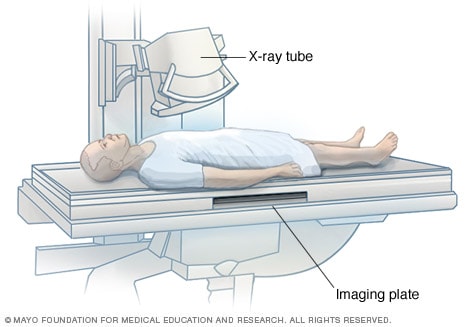 مردی که در حال معاینه اشعه ایکس است