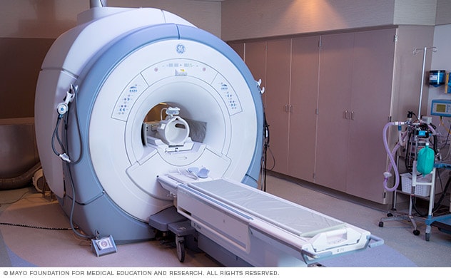 اسکن MRI مغز