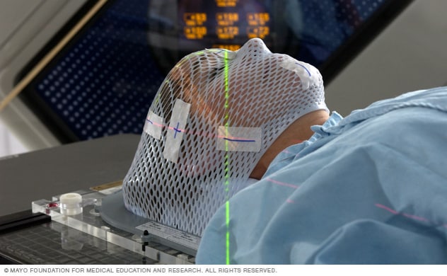 ماسک صورت برای رادیوسرجری استریوتاکتیک مغز LINAC